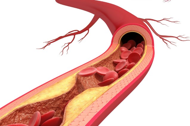 Gangrene Treatment In Hyderabad